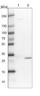 Western Blot: Tollip Antibody [NBP1-81596]