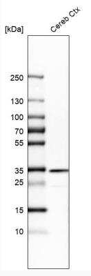 Western Blot: Tollip Antibody [NBP1-81597]