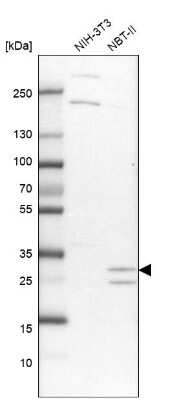 Western Blot: Tollip Antibody [NBP1-81597]