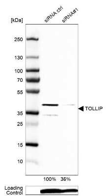 Western Blot: Tollip Antibody [NBP1-81597]