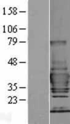 Western Blot: Tollip Overexpression Lysate [NBP2-04375]