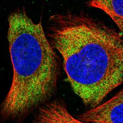 Immunocytochemistry/ Immunofluorescence: Tomosyn Antibody [NBP2-56176]