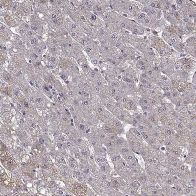 Immunohistochemistry-Paraffin: Tomosyn Antibody [NBP2-56176]