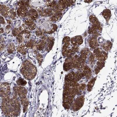 Immunohistochemistry-Paraffin: Tomosyn Antibody [NBP2-56176]