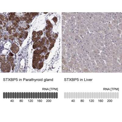Immunohistochemistry-Paraffin: Tomosyn Antibody [NBP2-56176]