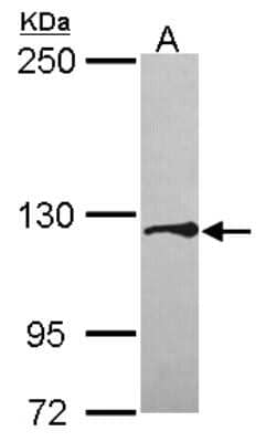 Western Blot: Tomosyn Antibody [NBP2-20683]