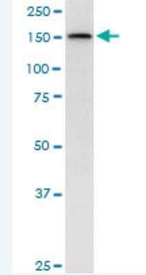 Western Blot: TopBP1 Antibody (6D12) [H00011073-M04-100ug]
