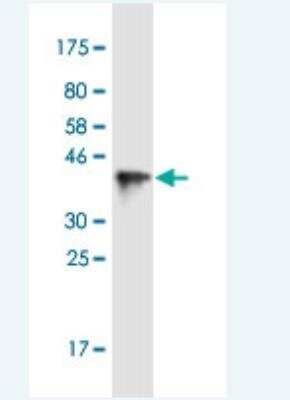 Western Blot: TopBP1 Antibody (6D12) [H00011073-M04-100ug]