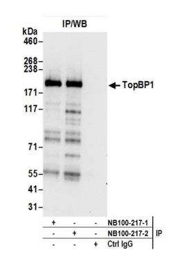 Immunoprecipitation: TopBP1 Antibody [NB100-217]