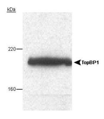 Western Blot: TopBP1 Antibody [NB100-217]