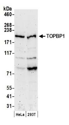 Western Blot: TopBP1 Antibody [NB100-217]