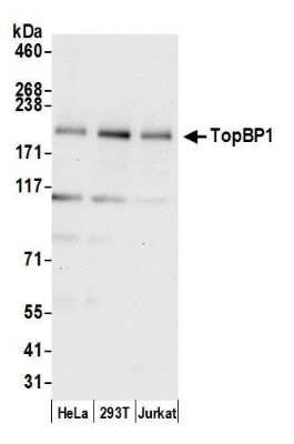 Western Blot: TopBP1 Antibody [NB100-217]
