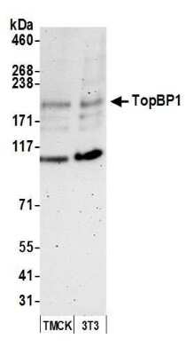 Western Blot: TopBP1 Antibody [NB100-217]