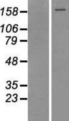 Western Blot: TOP2A Overexpression Lysate [NBP2-10912]