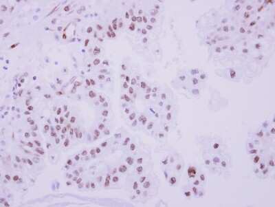 Immunohistochemistry-Paraffin: TOP2B Antibody [NBP2-20684]