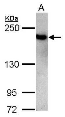 Western Blot: TOP2B Antibody [NBP2-20684]