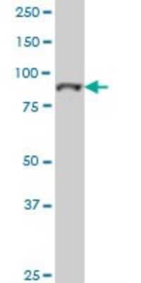 Western Blot: Topo III beta Antibody (4F11) [H00008940-M01]