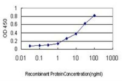 ELISA: Topoisomerase I Antibody (1A1) [H00007150-M01]