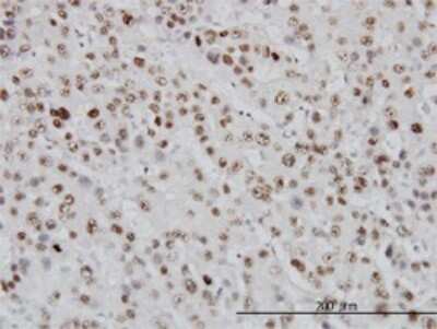 Immunohistochemistry-Paraffin: Topoisomerase I Antibody (1A1) [H00007150-M01]