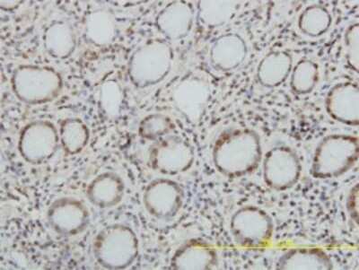 Immunohistochemistry-Paraffin: Topoisomerase I Antibody (1A1) [H00007150-M01]
