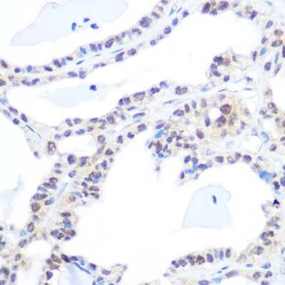 Immunohistochemistry-Paraffin: Topoisomerase I Antibody (3D4W6) [NBP3-15450]