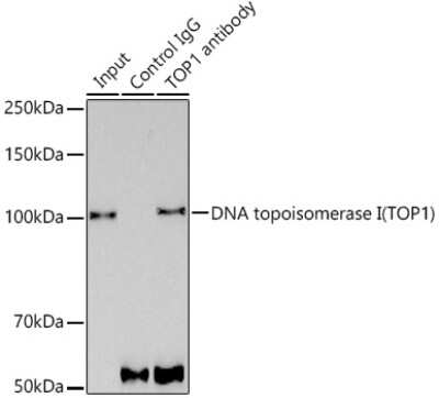 Immunoprecipitation: Topoisomerase I Antibody (3D4W6) [NBP3-15450]