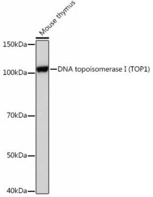 Western Blot: Topoisomerase I Antibody (3D4W6) [NBP3-15450]