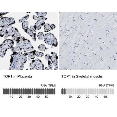 Immunohistochemistry-Paraffin: Topoisomerase I Antibody [NBP1-90365]