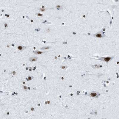 Immunohistochemistry-Paraffin: Topoisomerase I Antibody [NBP1-90365]