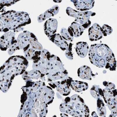 Immunohistochemistry-Paraffin: Topoisomerase I Antibody [NBP1-90365]