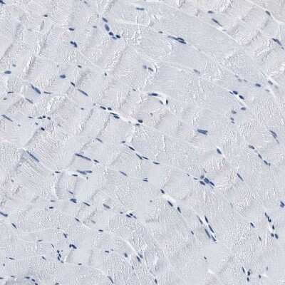 Immunohistochemistry-Paraffin: Topoisomerase I Antibody [NBP1-90365]