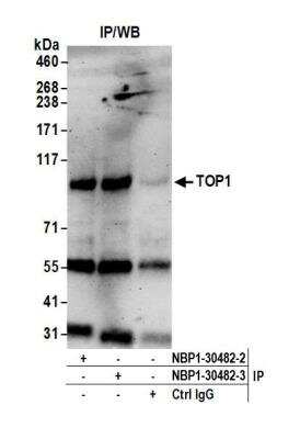 Immunoprecipitation: Topoisomerase I Antibody [NBP1-30482]