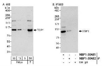 Western Blot: Topoisomerase I Antibody [NBP1-30481]