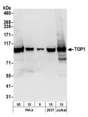 Western Blot: Topoisomerase I Antibody [NBP1-30482]