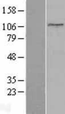 Western Blot: Topoisomerase I Overexpression Lysate [NBL1-17194]