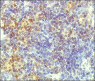 Immunohistochemistry: TORC2 Antibody - BSA Free [NBP2-22356]