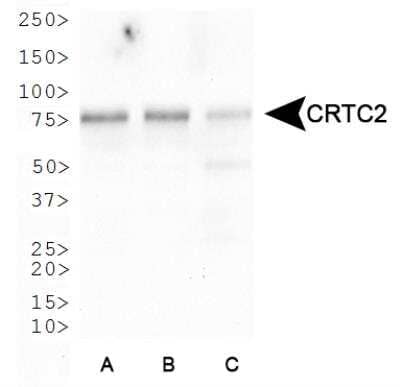 Western Blot: TORC2 AntibodyBSA Free [NBP2-22356]