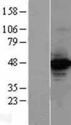 Western Blot: TORC2 Overexpression Lysate [NBL1-09492]