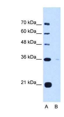 Western Blot: Torsin 1B Antibody [NBP1-62568]