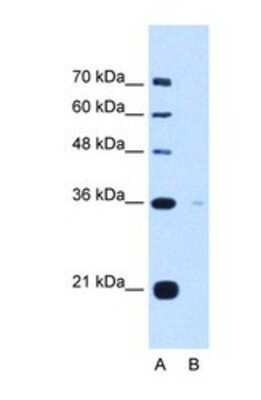 Western Blot: Torsin 1B Antibody [NBP1-69580]