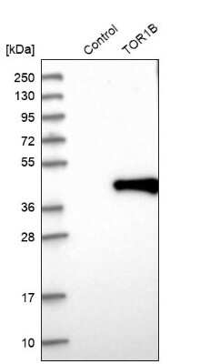 Western Blot: Torsin 1B Antibody [NBP1-84983]