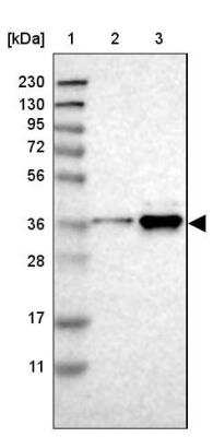 Western Blot: Torsin 1B Antibody [NBP1-84984]