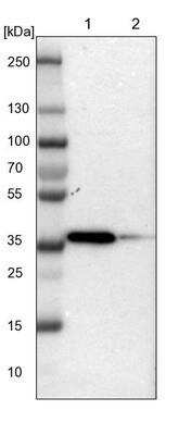 Western Blot: Torsin 1B Antibody [NBP1-84984]