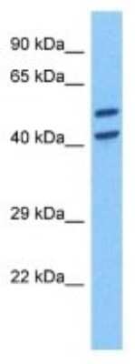 Western Blot: Torsin 1B Antibody [NBP3-10005]