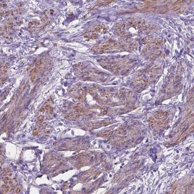 Immunohistochemistry-Paraffin: Torsin 2A Antibody [NBP2-68915]