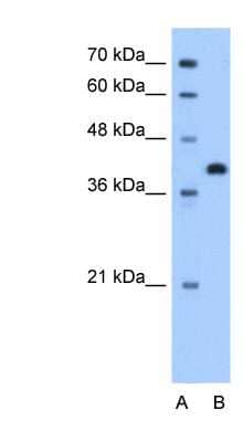 Western Blot: Torsin 2A Antibody [NBP1-60002]