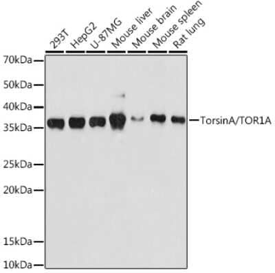 Western Blot: Torsin A Antibody (4Q2I9) [NBP3-16831]