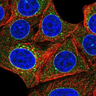 Immunocytochemistry/ Immunofluorescence: Torsin A Antibody [NBP2-56137]