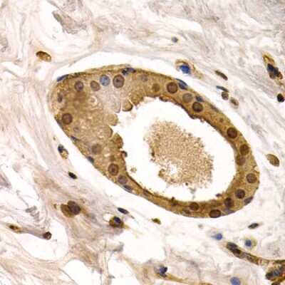 Immunohistochemistry-Paraffin: Torsin A Antibody - BSA Free [NBP3-03780]