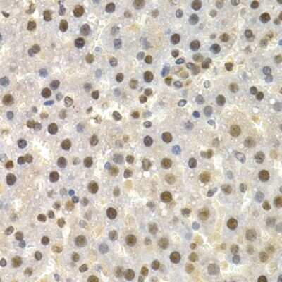 Immunohistochemistry-Paraffin: Torsin A Antibody - BSA Free [NBP3-03780]